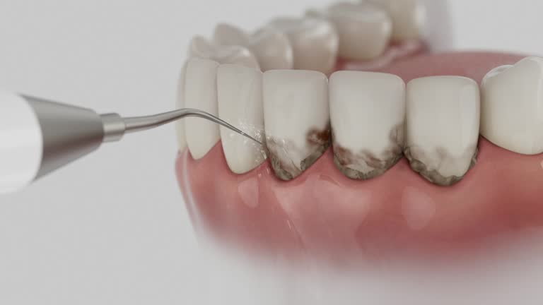 Reliable Teeth Cleaning And Checkup contractor in Williams, OR by Smile Center Dentistry